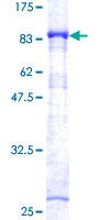 12.5% SDS-PAGE Stained with Coomassie Blue.